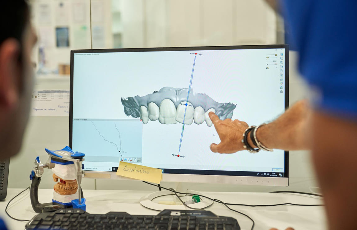 Impressão 3D na Odontologia