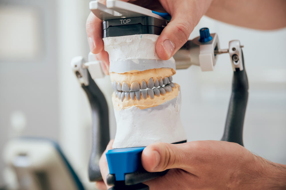 Principais erros na impressão 3D odontológica de iniciantes